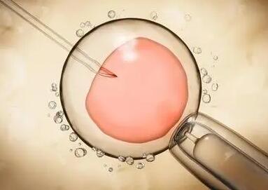 囊胚移植成功十个征兆集锦，那些着床最准的信号别忽视